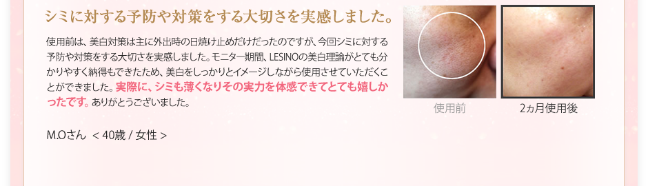 シミに対する予防や対策をする大切さを実感しました。