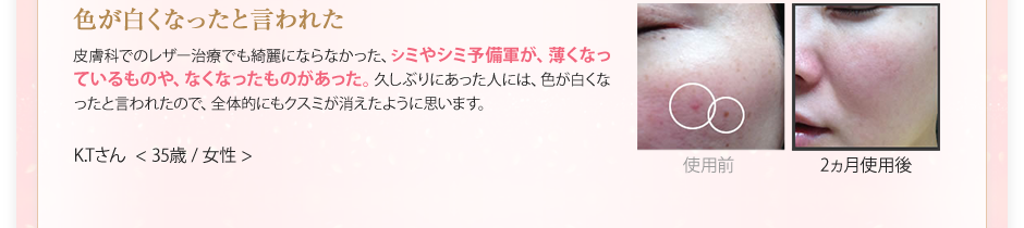 色が白くなったと言われた