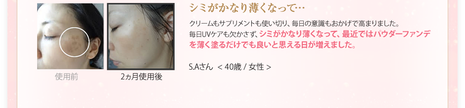 シミがかなり薄くなって…